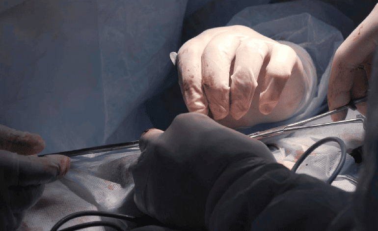 Innovación en Cirugía endovascular en Guadalajara: Tratamientos de Vanguardia