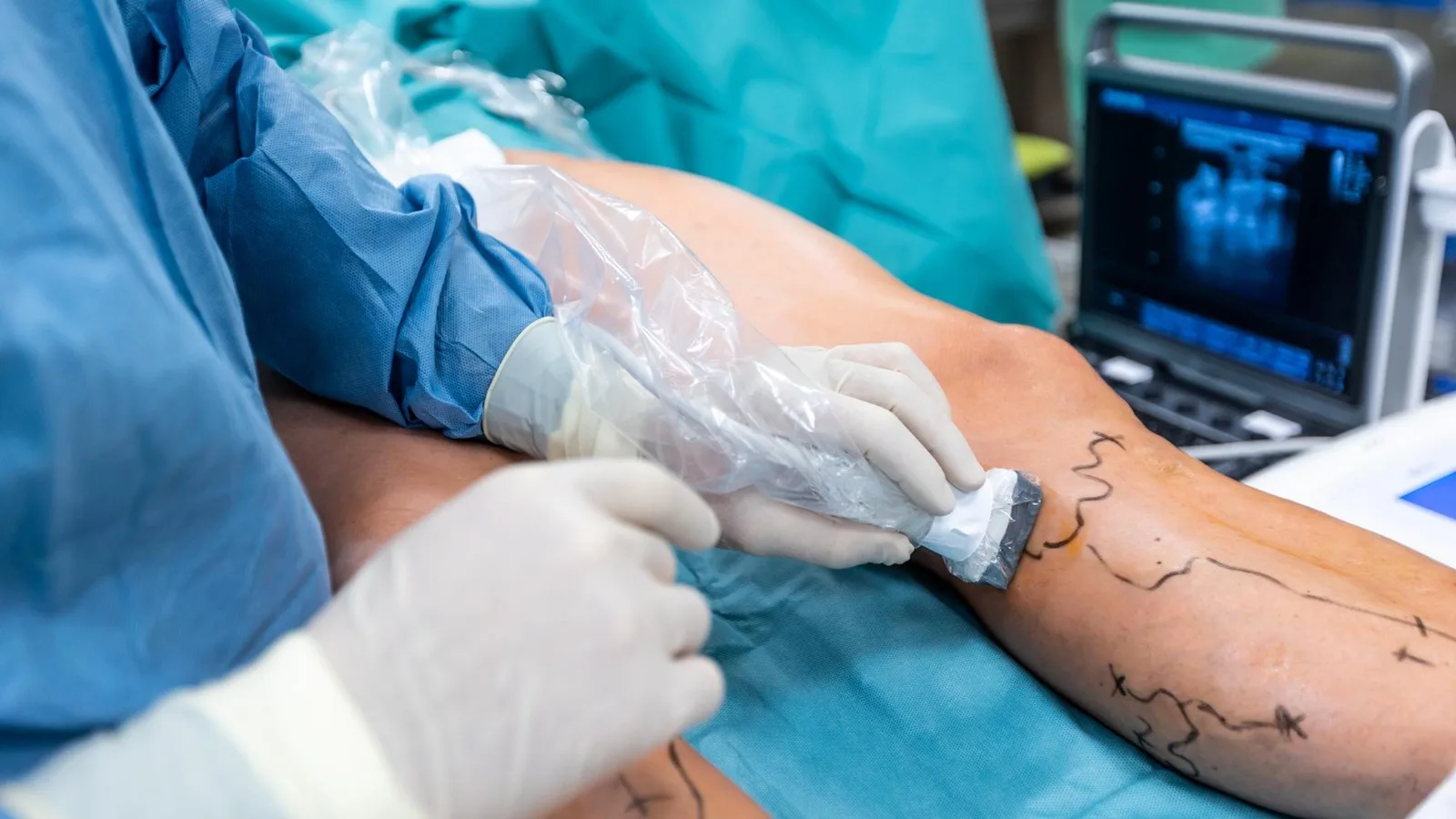 qué médico trata edema en piernas