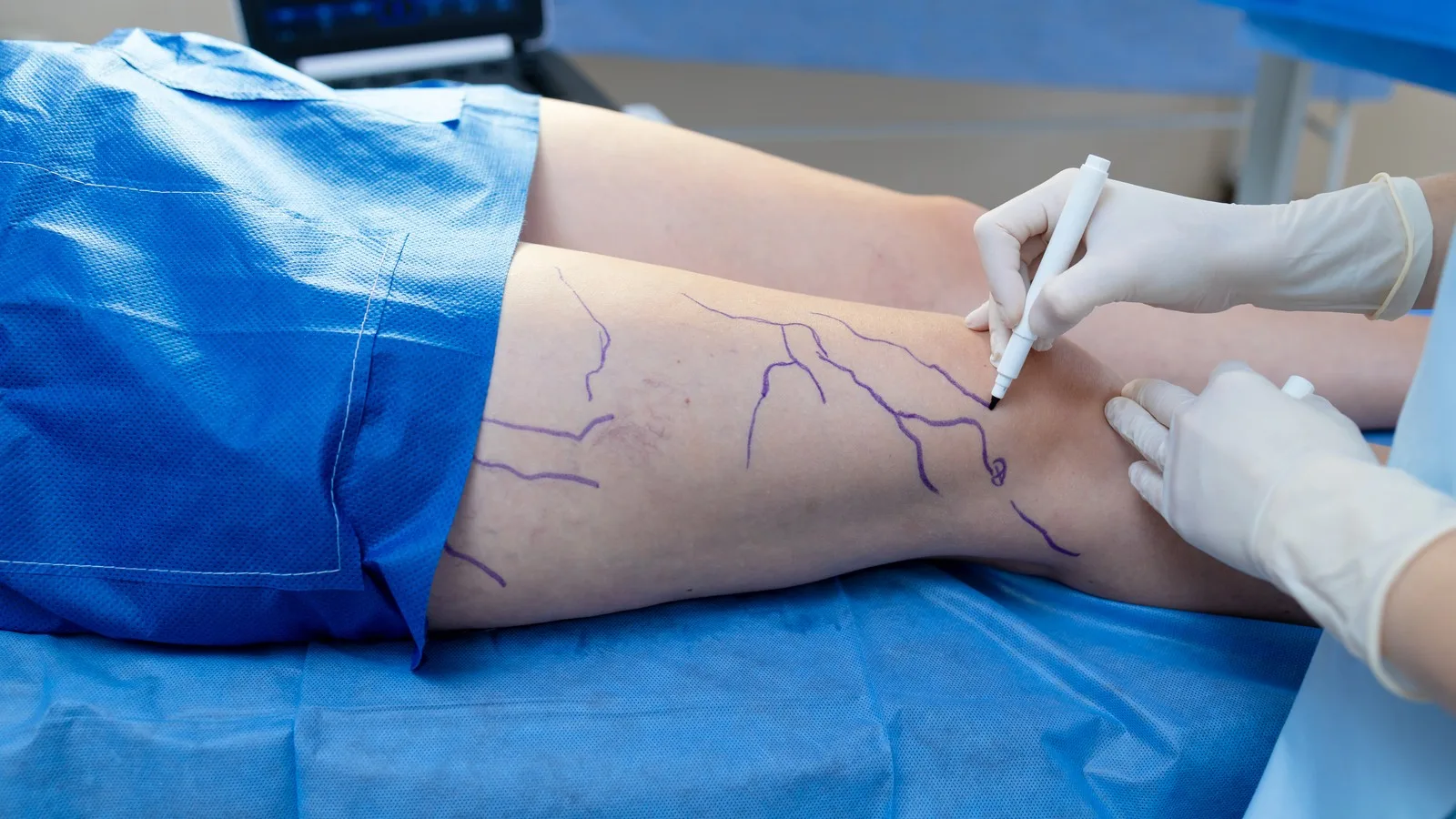 qué médico trata embolia arterial