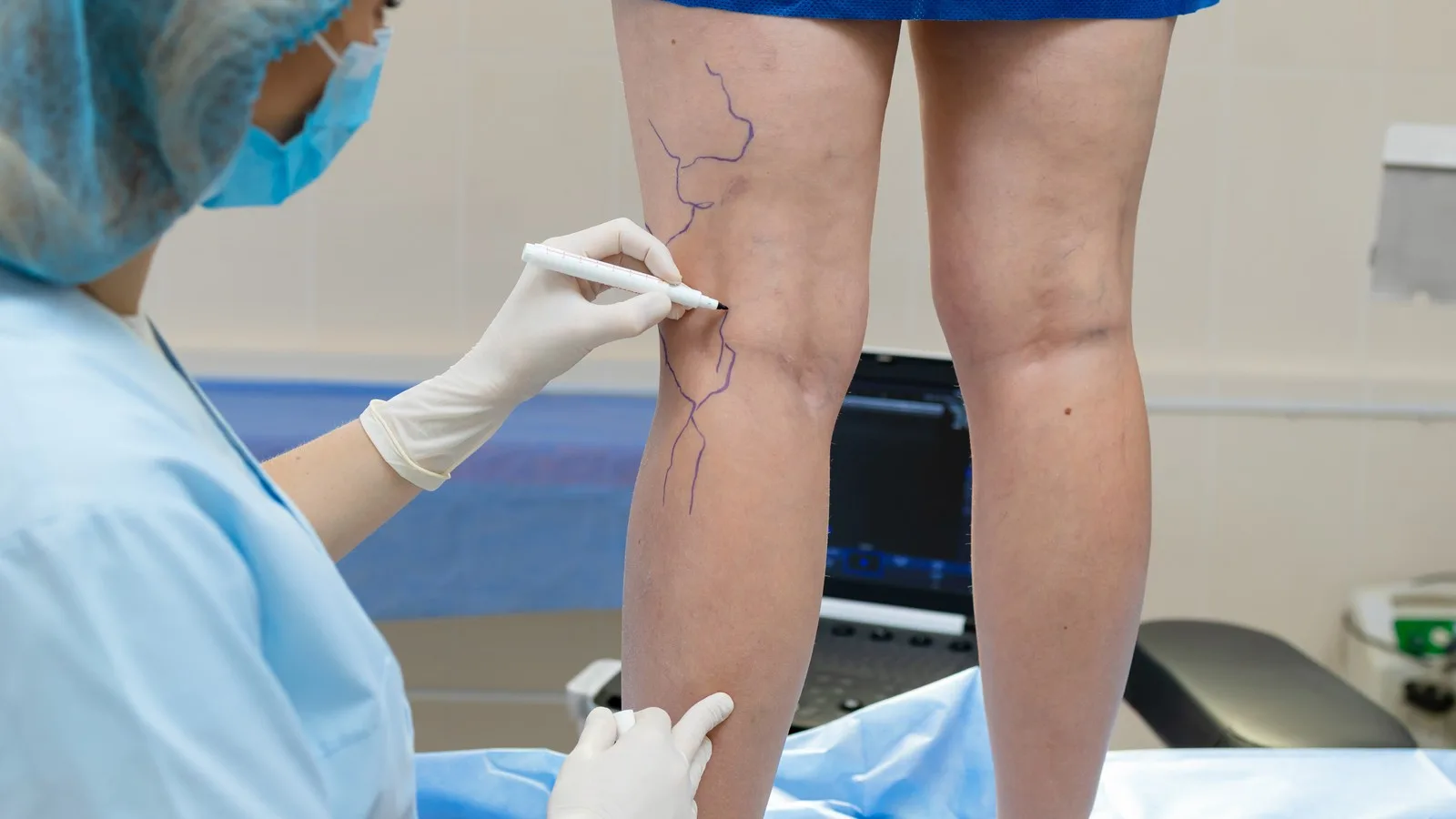 Isquemia de extremidades: Diagnóstico y rescate vascular en Guadalajara