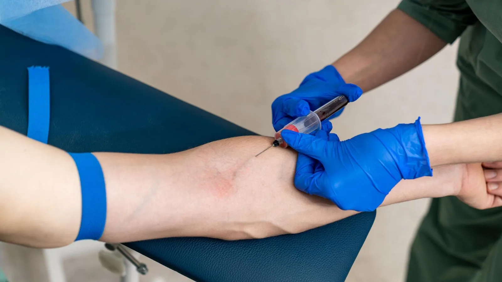 qué médico trata isquemia de extremidades