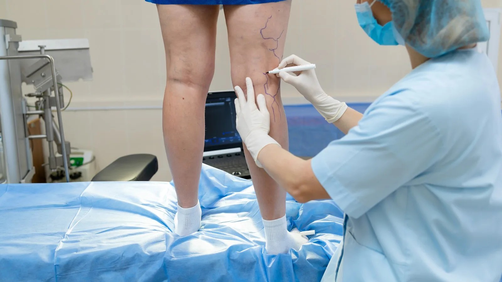 ¿Qué médico trata el linfedema en Guadalajara?